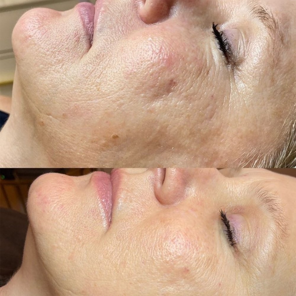 procell-before-after-3