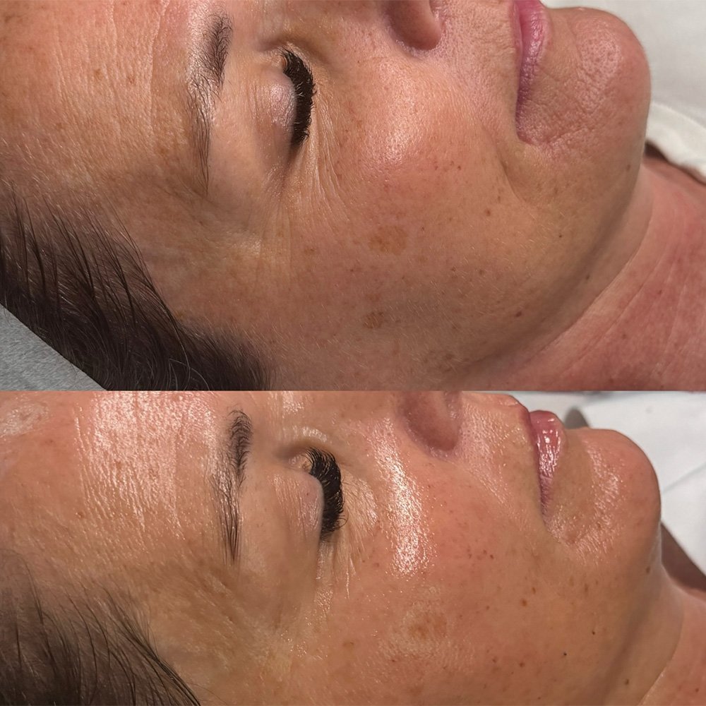 procell-before-after-5