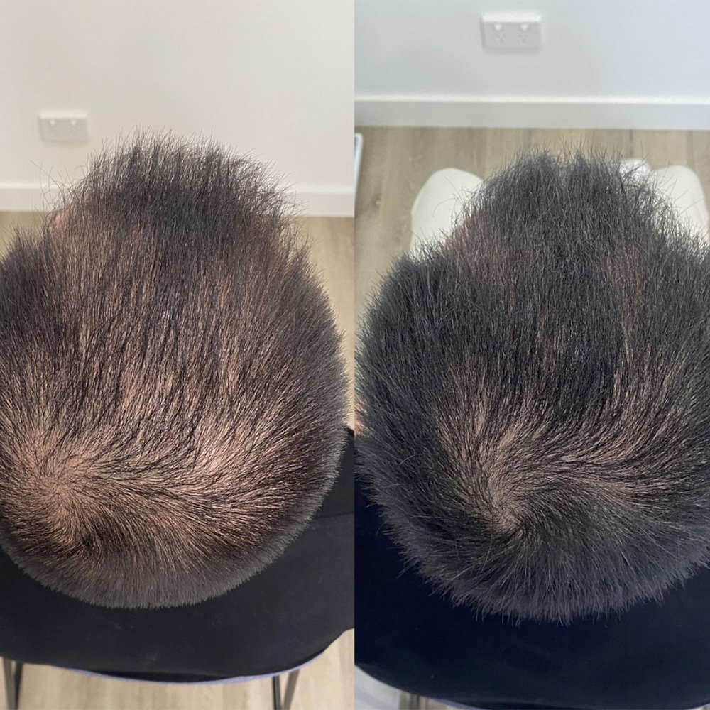 procell-before-after-7