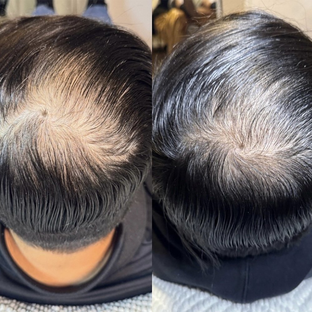 procell-before-after-8